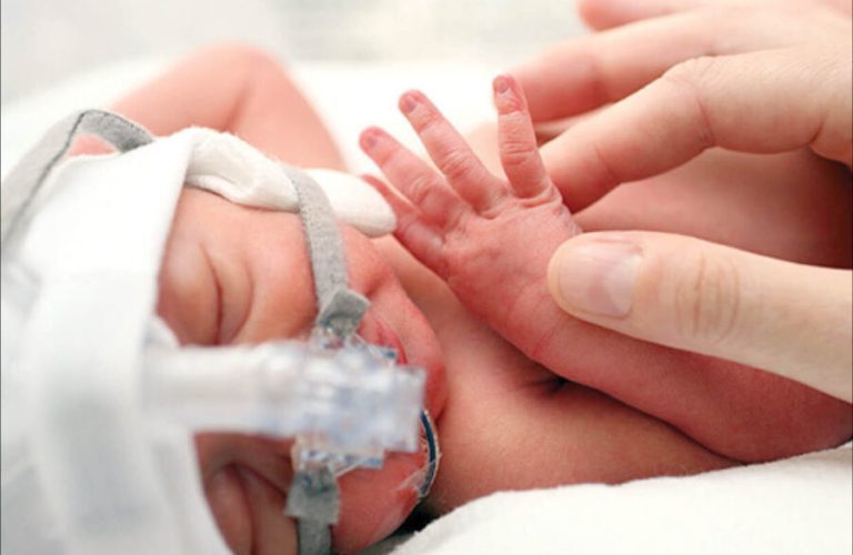 Premature-birth-and-its-factors-r98d4z7r83v5bc2njriaadnl19ajggcuabxrwpotc8