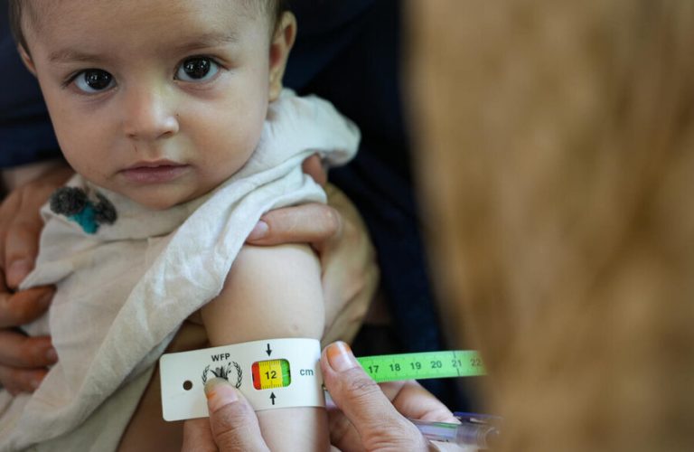 These families in Jalalabad receive their last food ration from WFP. They are among 2 million people WFP was forced to cut off assistance this month, due to a massive funding shortfall. This brings the total of people cut off from food assistance this year to 10 million — all of whom have very little alternative options to feed their families. Most of the families have 6 or 7 mouths to feed, and without WFP food assistance, they are forced to resort to negative coping mechanisms like begging in order to get enough food for a single meal.

WFP in Afghanistan is forced to drop another 2 million hungry people from food assistance in September, bringing it to a total of 10 million people cut off assistance this year. Going forward, WFP will only still be able to support 3 million people per month with emergency assistance, due to a massive funding shortfall this year.
In March, WFP had to reduce rations from 75 to 50 percent for communities experiencing emergency levels of hunger. In April and May, WFP was forced to cut a total of 8 million people struggling to get by from food assistance. WFP is often the last lifeline for women, who are increasingly being pushed out of society, with dwindling options of making a living and feeding their children.
These cuts mean that 1.4 million new and expecting mothers and their children are no longer receiving specialized food designed to prevent malnutrition. We expect to see a sharp rise in admissions to nutrition centers in the months to come as children slide deeper into hunger.
For the coming six months, WFP needs US$1 billion to reach 21 million people with lifesaving food, nutrition, and livelihood support. This includes funding to preposition food for communities that will become completely cut off during the harsh Afghan winter.