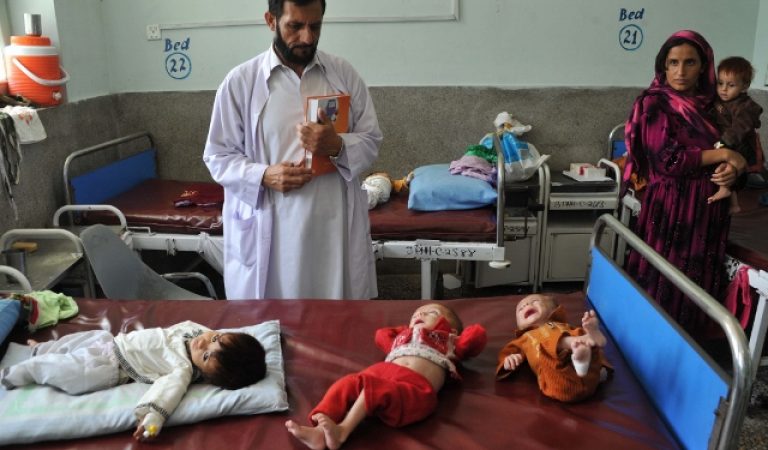 Afghan children suffering from severe malnutrition receive treatment at a public hospital in Jalalabad on September 24, 2013. A study on the situation of nutrition in Afghanistan showed that over six percent of children under the age of five suffer from a