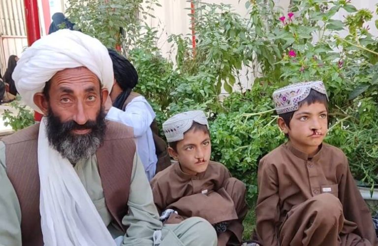 شونډو پرې ماشومان