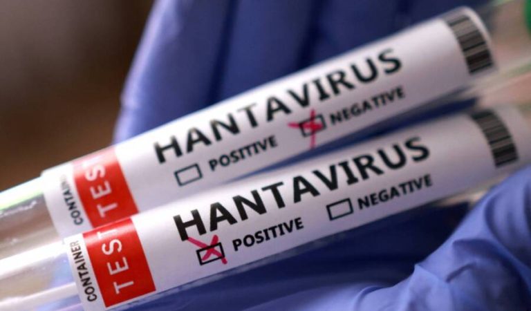 Test tubes labelled "Hantavirus positive and negative" are held in this illustration taken May 7, 2026. REUTERS/Dado Ruvic/Illustration