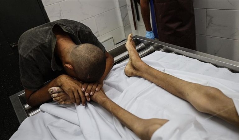 Severe famine and hunger in Gaza