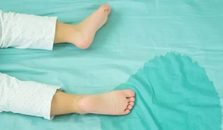 Urinary-incontinence