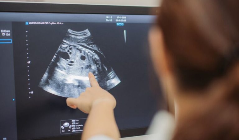 parenting-ultrasounds-superJumbo 1