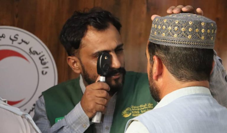 کوز کسل‌لیکلرینی دوالش