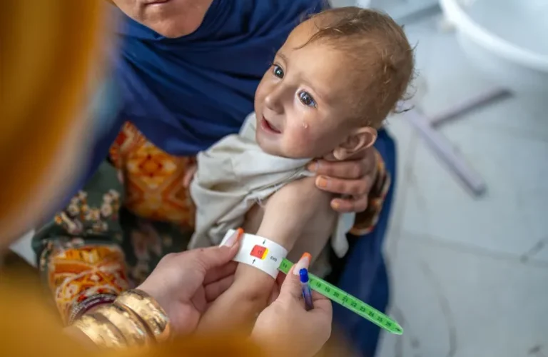 Child Malnutrition in Afghanistan