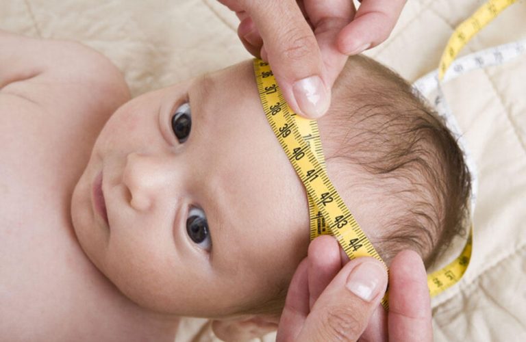 Lack of facilities for diagnosing and treating hydrocephalus in Takhar has left pregnant women stranded